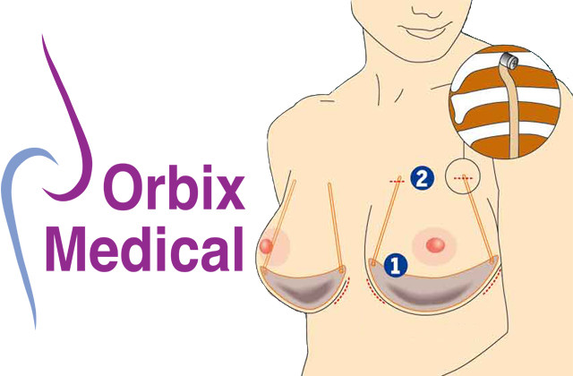 Soutien-gorge invisible Orbix Medical